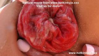 Kinky Hotkinkyjo Ass🍑 Fisting and Extreme Prolapse at Beachside Villa